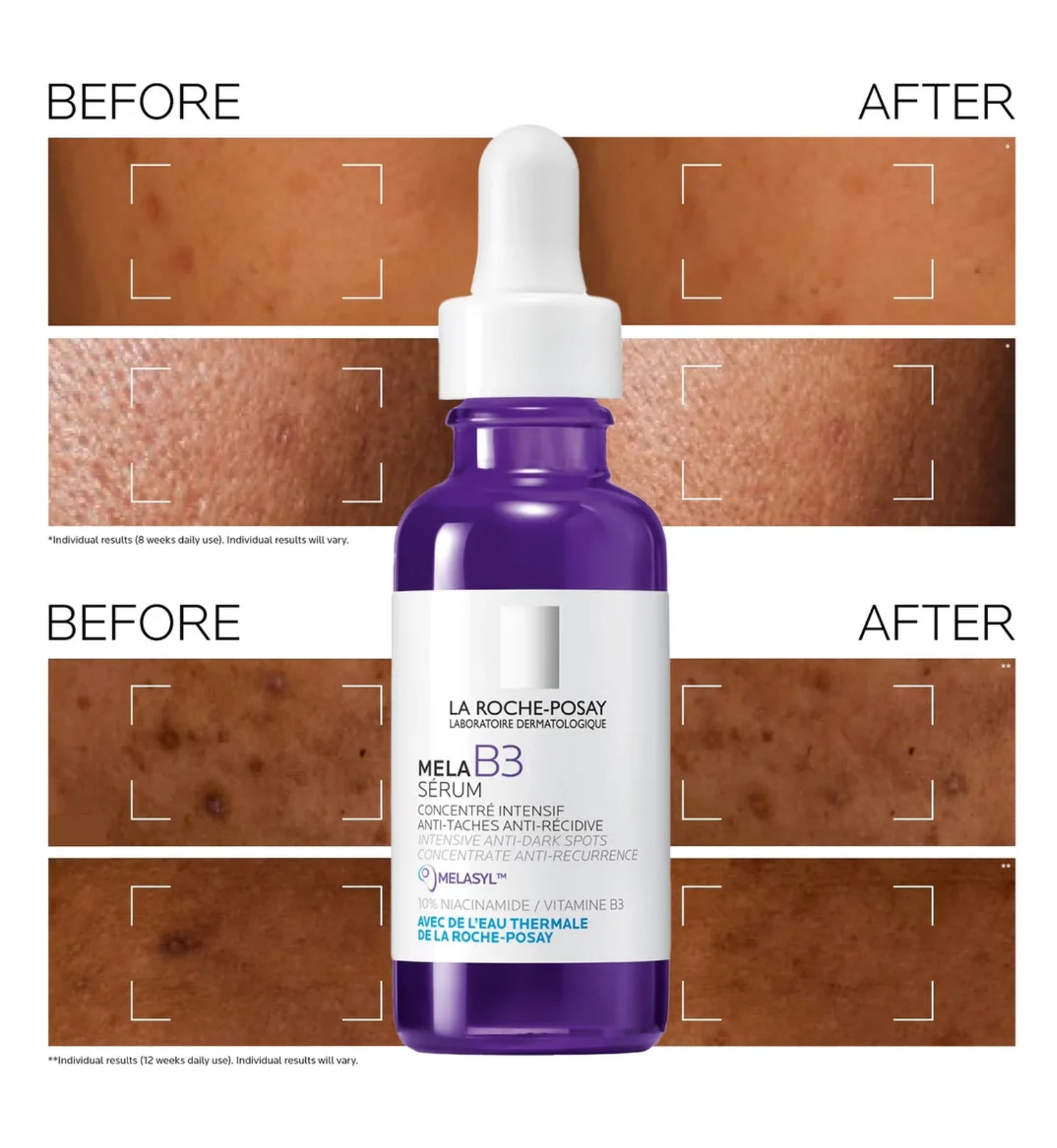 La Roche-Posay
Mela B3 Niacinamide Dark Spot Corrector Serum 30ml