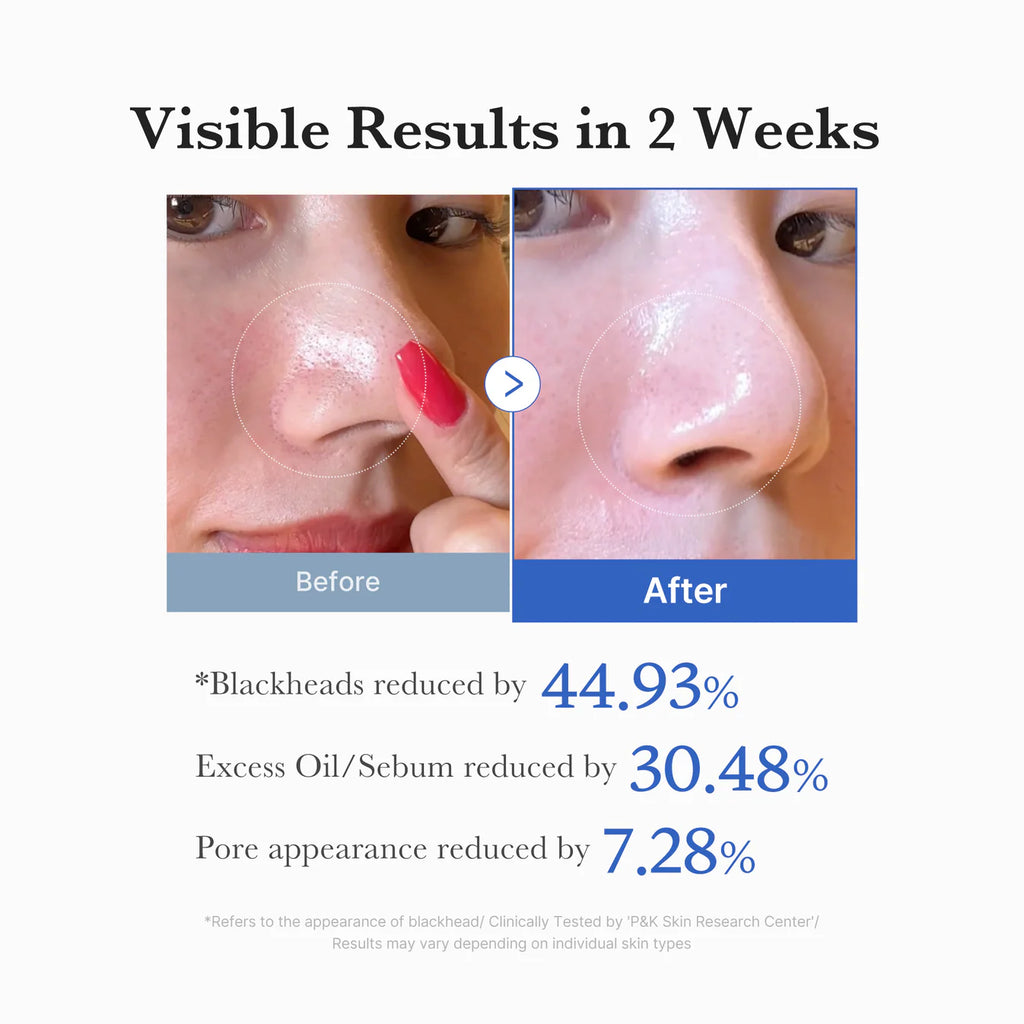 Medicube
Medicube Zero Pore