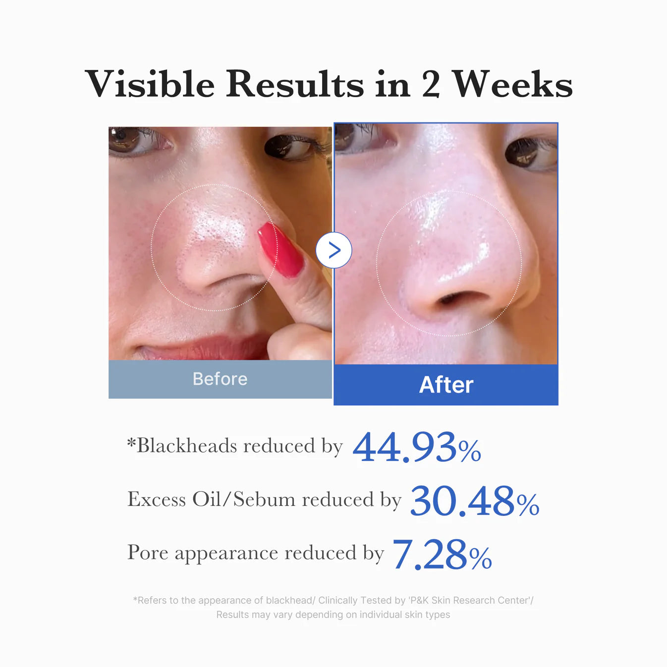 Medicube
Medicube Zero Pore